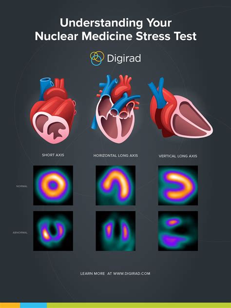 is stress test hard|abnormal stress test no blockage.